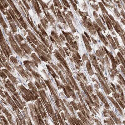 Immunohistochemistry-Paraffin: Pyruvate Dehydrogenase E1 beta subunit Antibody [NBP1-87421]