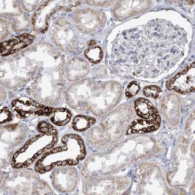 Immunohistochemistry-Paraffin: Pyruvate Dehydrogenase E1 beta subunit Antibody [NBP1-87421]