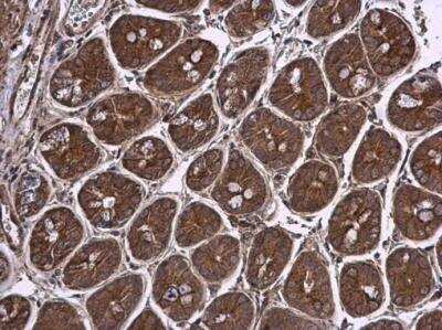 Immunohistochemistry-Paraffin: Pyruvate Dehydrogenase E1 beta subunit Antibody [NBP2-20024]