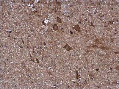 Immunohistochemistry-Paraffin: Pyruvate Dehydrogenase E1 beta subunit Antibody [NBP2-20024]