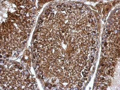 Immunohistochemistry-Paraffin: Pyruvate Dehydrogenase E1 beta subunit Antibody [NBP2-20025]
