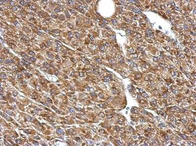 Immunohistochemistry-Paraffin: Pyruvate Dehydrogenase E1 beta subunit Antibody [NBP2-20025]