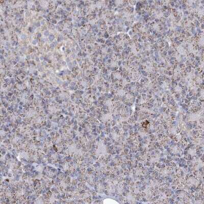 Immunohistochemistry-Paraffin: Pyruvate Dehydrogenase E1 beta subunit Antibody [NBP2-38327]