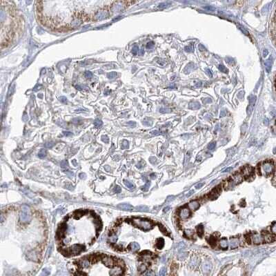 Immunohistochemistry-Paraffin: Pyruvate Dehydrogenase E1 beta subunit Antibody [NBP2-38327]