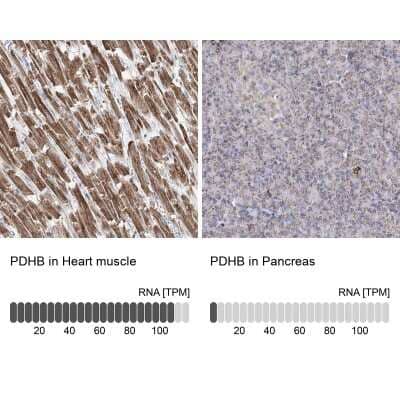 Immunohistochemistry-Paraffin: Pyruvate Dehydrogenase E1 beta subunit Antibody [NBP2-38327]