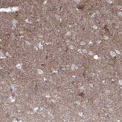 Immunohistochemistry-Paraffin: Pyruvate Dehydrogenase E1 beta subunit Antibody [NBP2-38327]