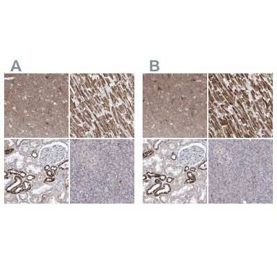 Immunohistochemistry-Paraffin: Pyruvate Dehydrogenase E1 beta subunit Antibody [NBP2-38327]