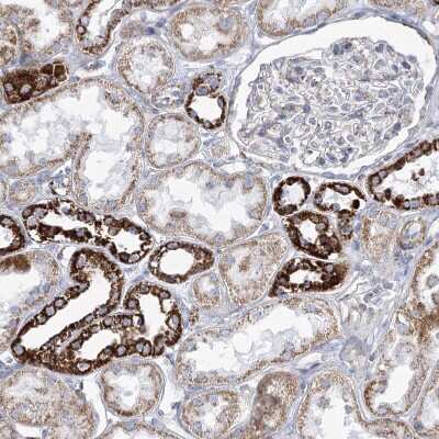Immunohistochemistry-Paraffin: Pyruvate Dehydrogenase E1 beta subunit Antibody [NBP2-38327]