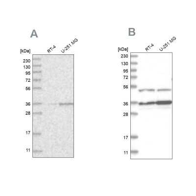 Western Blot: Pyruvate Dehydrogenase E1 beta subunit Antibody [NBP1-87421]