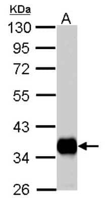 Western Blot: Pyruvate Dehydrogenase E1 beta subunit Antibody [NBP2-20024]