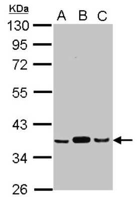 Western Blot: Pyruvate Dehydrogenase E1 beta subunit Antibody [NBP2-20024]