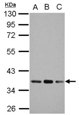 Western Blot: Pyruvate Dehydrogenase E1 beta subunit Antibody [NBP2-20025]