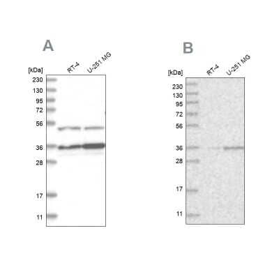 Western Blot: Pyruvate Dehydrogenase E1 beta subunit Antibody [NBP2-38327]