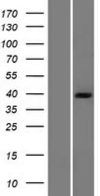 Western Blot: Pyruvate Dehydrogenase E1 beta subunit Overexpression Lysate [NBP2-11466]