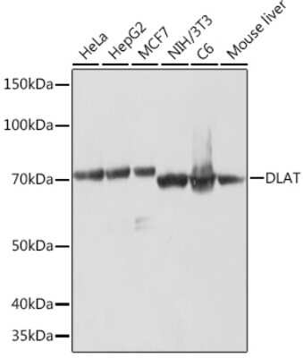 Western Blot: Pyruvate Dehydrogenase E2 Antibody (2Z7R10) [NBP3-16707]