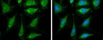 Immunocytochemistry/ Immunofluorescence: Pyruvate Dehydrogenase E2 Antibody [NBP2-20026]