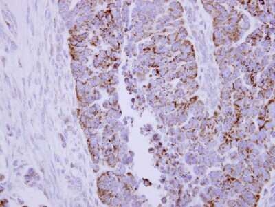 Immunohistochemistry-Paraffin: Pyruvate Dehydrogenase E2 Antibody [NBP2-20026]