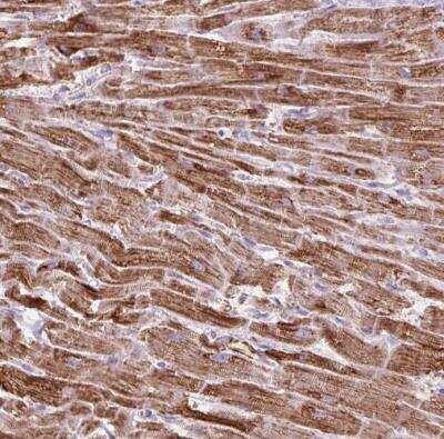 Immunohistochemistry-Paraffin: Pyruvate Dehydrogenase E2 Antibody [NBP2-34065]
