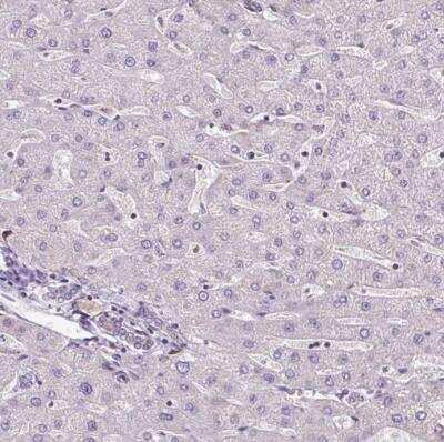 Immunohistochemistry-Paraffin: Pyruvate Dehydrogenase E2 Antibody [NBP2-34065]