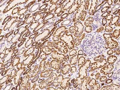 Immunohistochemistry-Paraffin: Pyruvate Dehydrogenase E2 Antibody [NBP2-99340]