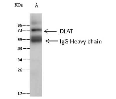 Immunoprecipitation: Pyruvate Dehydrogenase E2 Antibody [NBP2-99340]