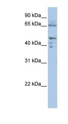 Western Blot: Pyruvate Dehydrogenase E2 Antibody [NBP1-54756]