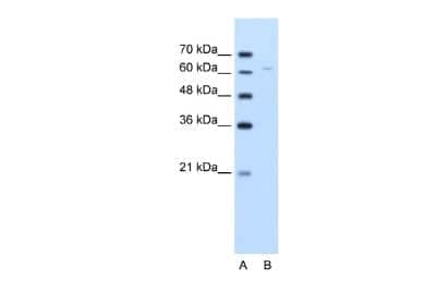 Western Blot: Pyruvate Dehydrogenase E2 Antibody [NBP1-54795]