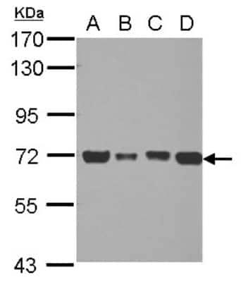 Western Blot: Pyruvate Dehydrogenase E2 Antibody [NBP2-20026]