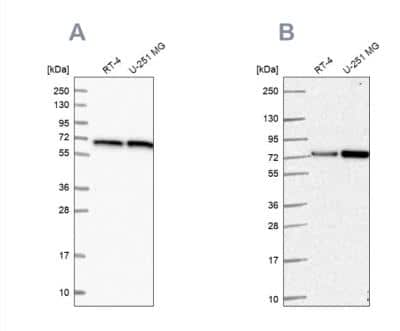 Western Blot: Pyruvate Dehydrogenase E2 Antibody [NBP2-34065]