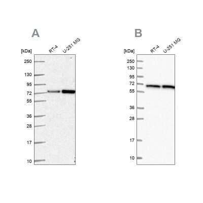 Western Blot: Pyruvate Dehydrogenase E2 Antibody [NBP2-56744]