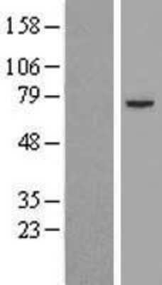 Western Blot: Pyruvate Dehydrogenase E2 Overexpression Lysate [NBL1-09906]