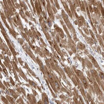 Immunohistochemistry-Paraffin: Pyruvate Dehydrogenase Kinase 1/PDK1 Antibody [NBP1-85955]