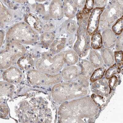 Immunohistochemistry-Paraffin: Pyruvate Dehydrogenase Kinase 1/PDK1 Antibody [NBP1-85955]