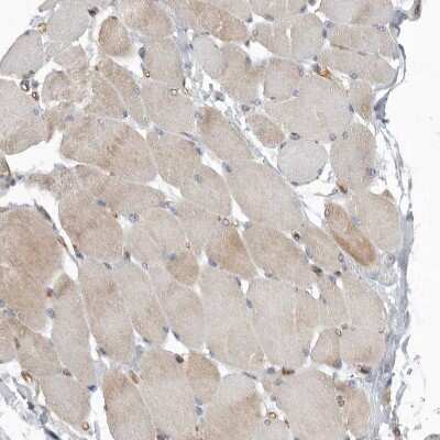 Immunohistochemistry-Paraffin: Pyruvate Dehydrogenase Kinase 1/PDK1 Antibody [NBP1-85955]