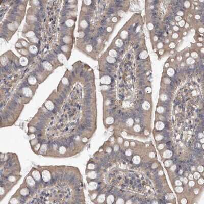 Immunohistochemistry-Paraffin: Pyruvate Dehydrogenase Kinase 1/PDK1 Antibody [NBP1-85955]