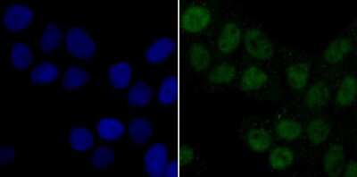 Immunocytochemistry/ Immunofluorescence: Pyruvate Dehydrogenase Kinase 1/PDK1 Antibody (JA67-30) [NBP2-67032]