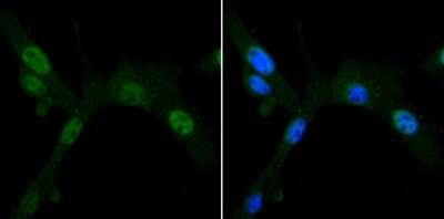 Immunocytochemistry/ Immunofluorescence: Pyruvate Dehydrogenase Kinase 1/PDK1 Antibody (JA67-30) [NBP2-67032]