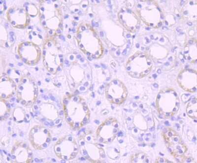 Immunohistochemistry-Paraffin: Pyruvate Dehydrogenase Kinase 1/PDK1 Antibody (JA67-30) [NBP2-67032]