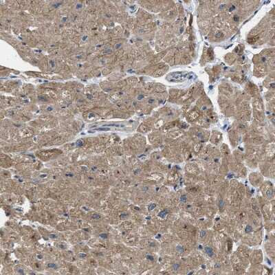 Immunohistochemistry-Paraffin: Pyruvate Dehydrogenase Phosphatase/PDP1/PPM2C Antibody [NBP1-82432]