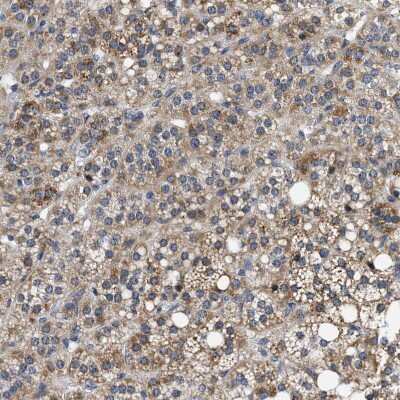 Immunohistochemistry-Paraffin: Pyruvate Dehydrogenase Phosphatase/PDP1/PPM2C Antibody [NBP1-87308]