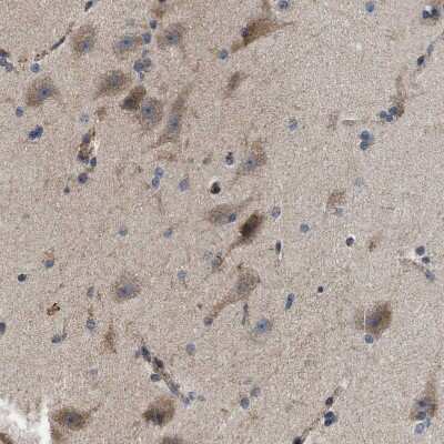 Immunohistochemistry-Paraffin: Pyruvate Dehydrogenase Phosphatase/PDP1/PPM2C Antibody [NBP1-87308]