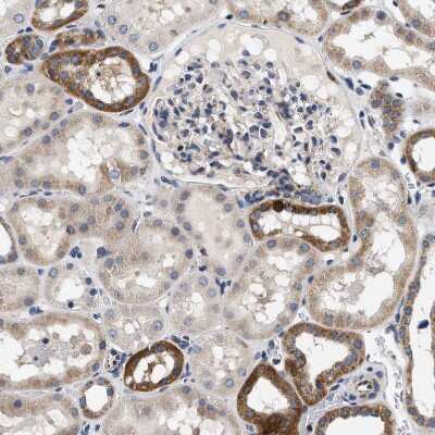 Immunohistochemistry-Paraffin: Pyruvate Dehydrogenase Phosphatase/PDP1/PPM2C Antibody [NBP1-87308]