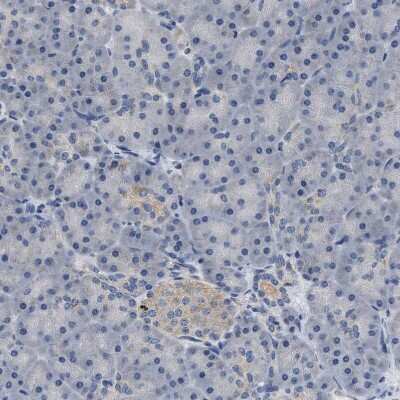 Immunohistochemistry-Paraffin: Pyruvate Dehydrogenase Phosphatase/PDP1/PPM2C Antibody [NBP1-87308]