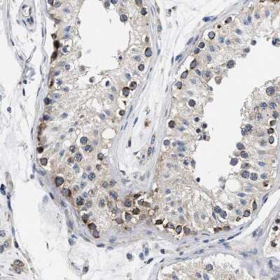 Immunohistochemistry-Paraffin: Pyruvate Dehydrogenase Phosphatase/PDP1/PPM2C Antibody [NBP1-87308]