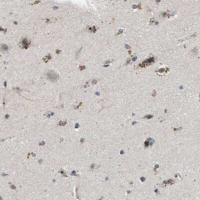 Immunohistochemistry-Paraffin: Pyruvate Dehydrogenase Phosphatase/PDP1/PPM2C Antibody [NBP1-87309]