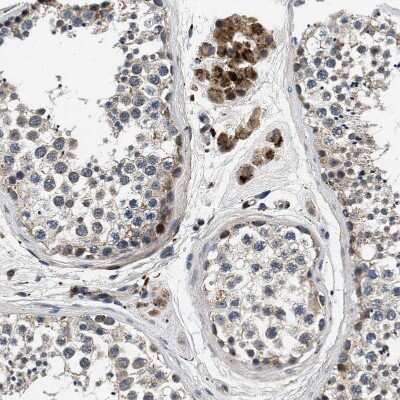 Immunohistochemistry-Paraffin: Pyruvate Dehydrogenase Phosphatase/PDP1/PPM2C Antibody [NBP1-87309]