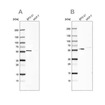 Western Blot: Pyruvate Dehydrogenase Phosphatase/PDP1/PPM2C Antibody [NBP1-82432]