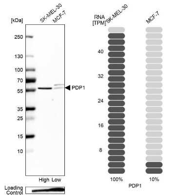 Western Blot: Pyruvate Dehydrogenase Phosphatase/PDP1/PPM2C Antibody [NBP1-87308]