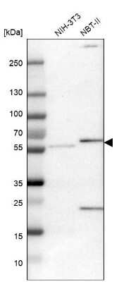 Western Blot: Pyruvate Dehydrogenase Phosphatase/PDP1/PPM2C Antibody [NBP1-87308]