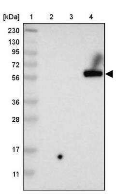 Western Blot: Pyruvate Dehydrogenase Phosphatase/PDP1/PPM2C Antibody [NBP1-87309]